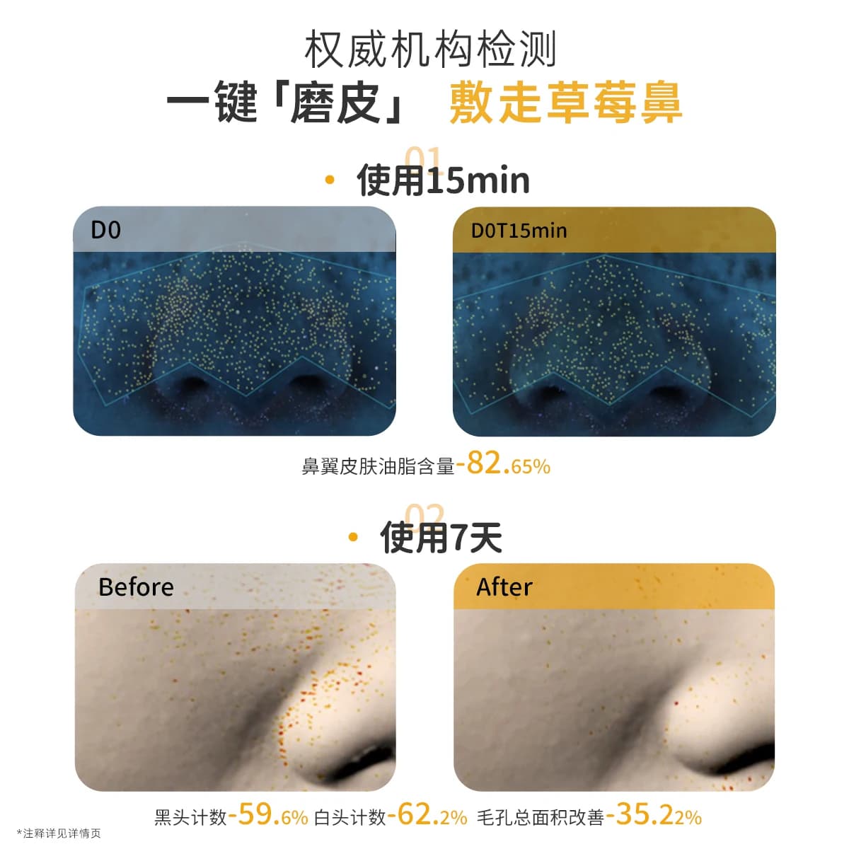 袋鼠妈妈青少年去黑头面膜鼻贴导出液收缩毛孔清洁粉刺男女草莓鼻 - 缩略图4