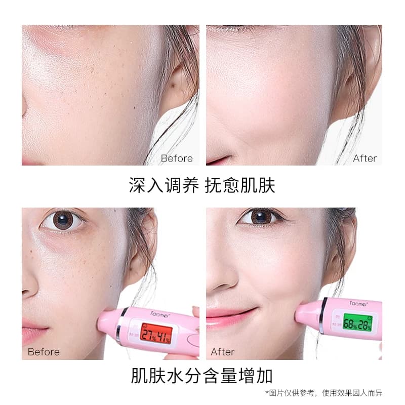 【周年店庆】贝玲美黄金贵妇奢宠九件套 - 缩略图2