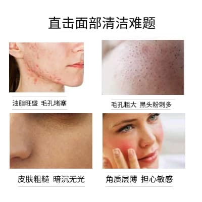 霓康堂毛孔清洁霜深层清洁排浊卸妆洁面按摩膏疏通毛孔黑头粉刺女 - 缩略图3