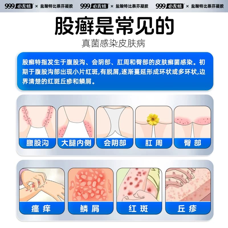 股癣股藓专用药大腿内侧皮肤瘙痒止痒999盐酸特比萘芬凝胶乳软膏 - 缩略图2
