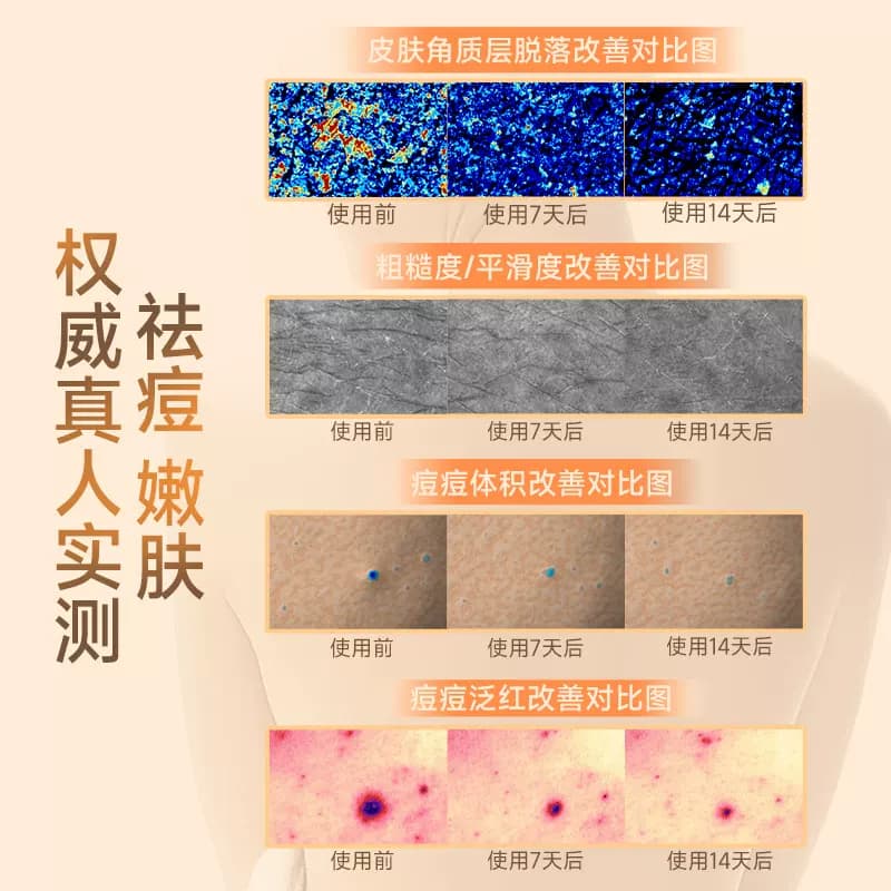 cibio2仲夏西柚果酸沐浴露420g保湿去角质祛痘嫩肤亮肤特调香氛 - 缩略图3