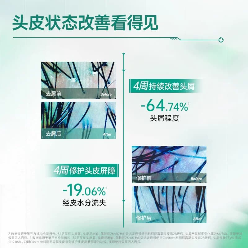 【新】科丽尼青蒿头皮素+清爽净屑洗发水去头屑修护舒缓控油敏感 - 缩略图4