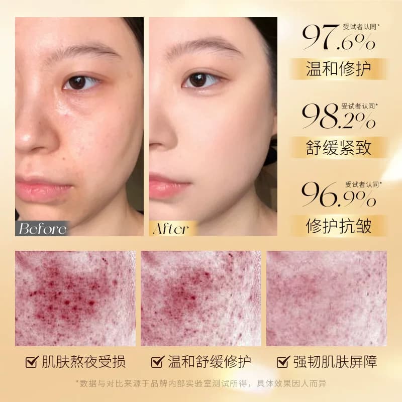 ERUYN多肽依克多因熬夜奢宠修护礼盒抗老舒缓淡纹A - 缩略图4