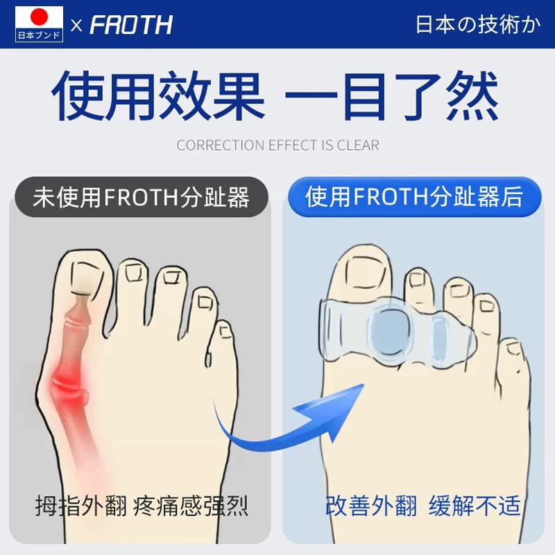 日本硅胶脚趾矫正器男女士拇指外翻三指分趾神器大母趾矫正可穿鞋 - 缩略图5