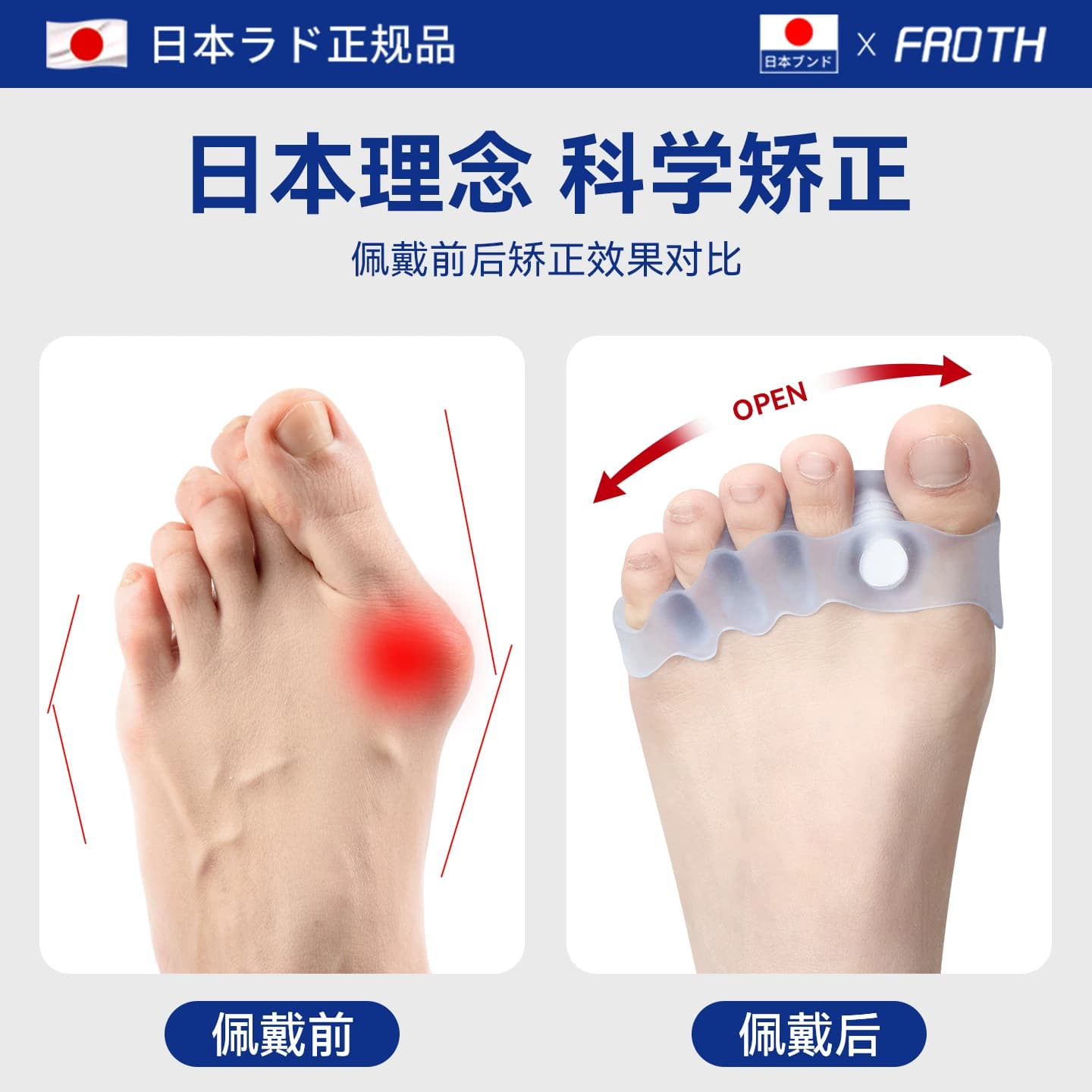 日本脚趾矫正器拇指外翻分趾器男女可穿鞋防磨纠正大脚骨突出神器 - 缩略图5