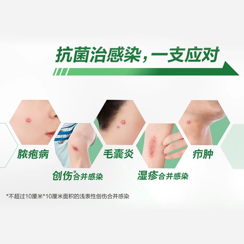 【原研药】百多邦莫匹罗星软膏抗菌正品毛囊炎消炎湿疹痘皮肤药膏 - 缩略图2