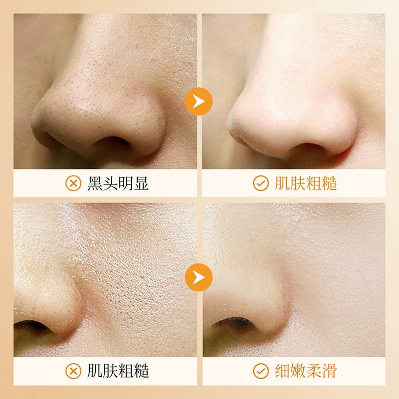【拍一发三】上朵五重VC涂抹式清洁泥膜泡泡面膜男女通用B - 缩略图5