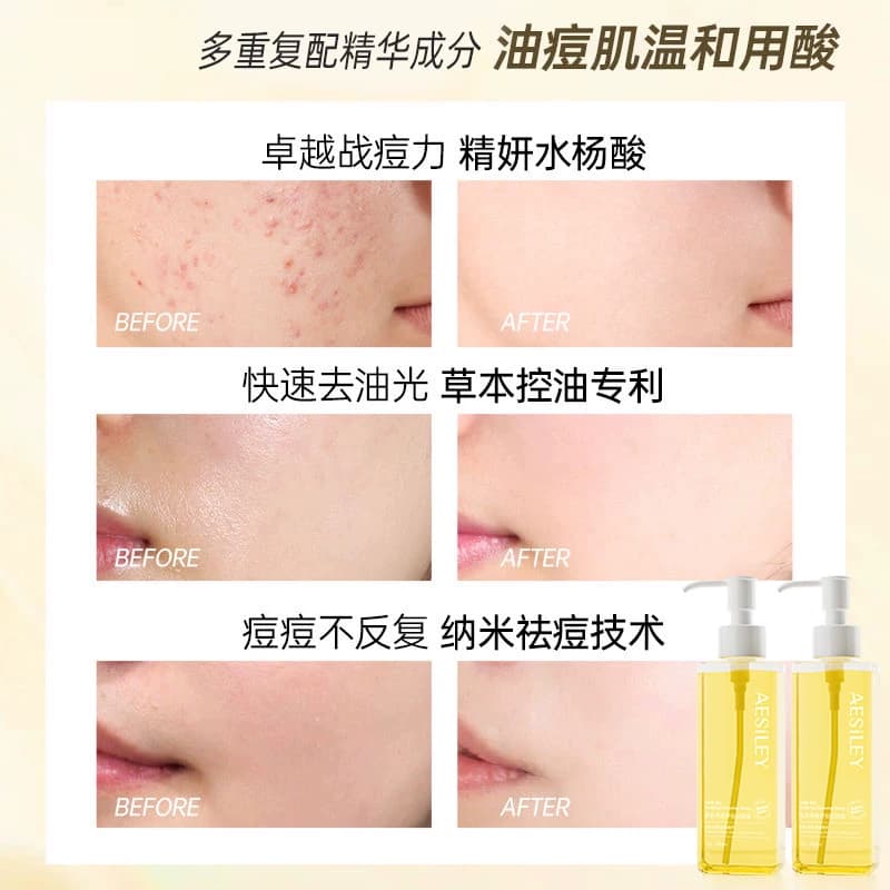 aesiley黑茶卸妆油净澈舒润洁颜蜜植萃水敏感肌眼唇脸干湿两用QZ - 缩略图4