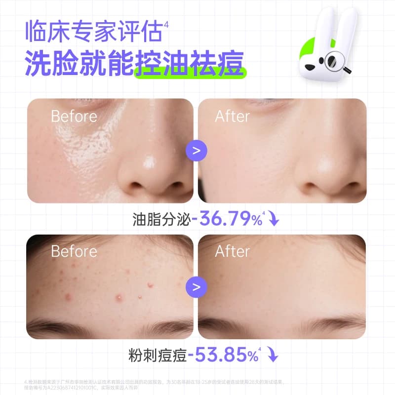 黑色木星祛痘洁面泡沫青少年洗面奶温和控油保湿敏感肌可用 - 缩略图3