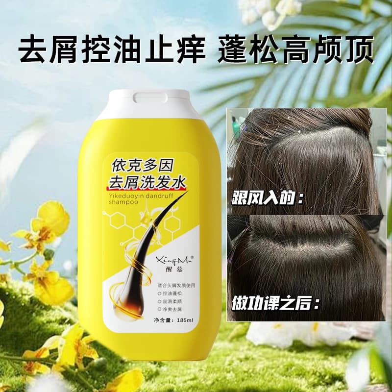 经典伊秀醒慕依克多因去屑洗发水温和头皮清洁控油丝滑小黄瓶正品 - 缩略图4