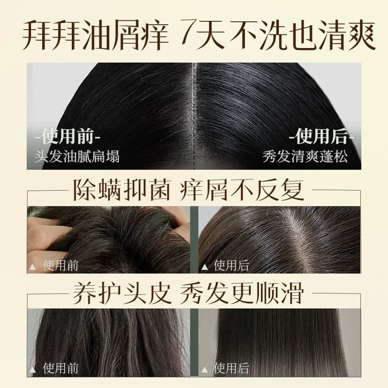 经典伊秀寻蜂之旅洗发水蜂蜜控油蓬松滋润修护毛躁受损去屑柔顺女 - 缩略图4