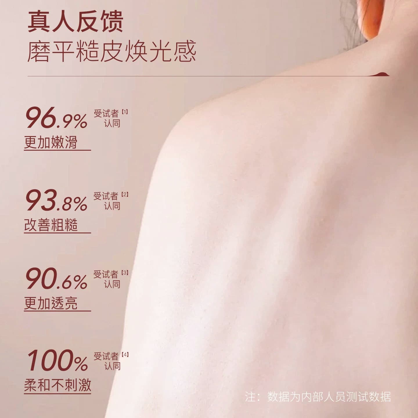 云感净背喷雾｜SD淳存2%复合乳酸净背喷雾水杨酸前后背痘牛奶酸 - 缩略图4