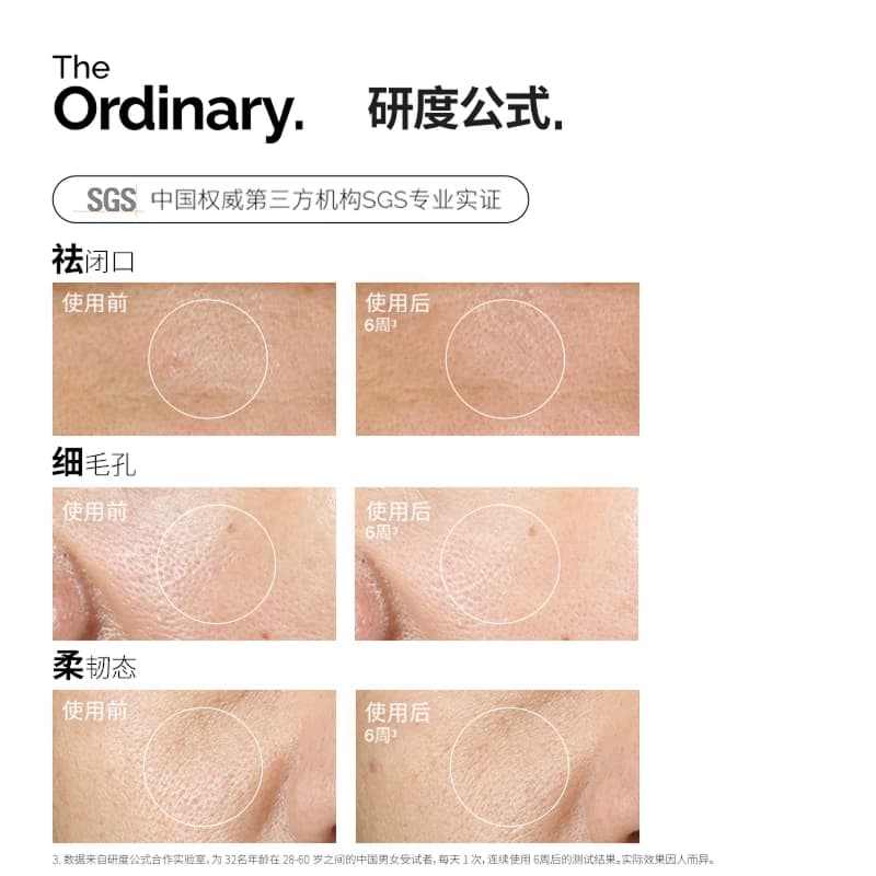 The Ordinary研度公式5%果酸水甘醇酸爽肤水去角质闭口提亮油皮 - 缩略图2