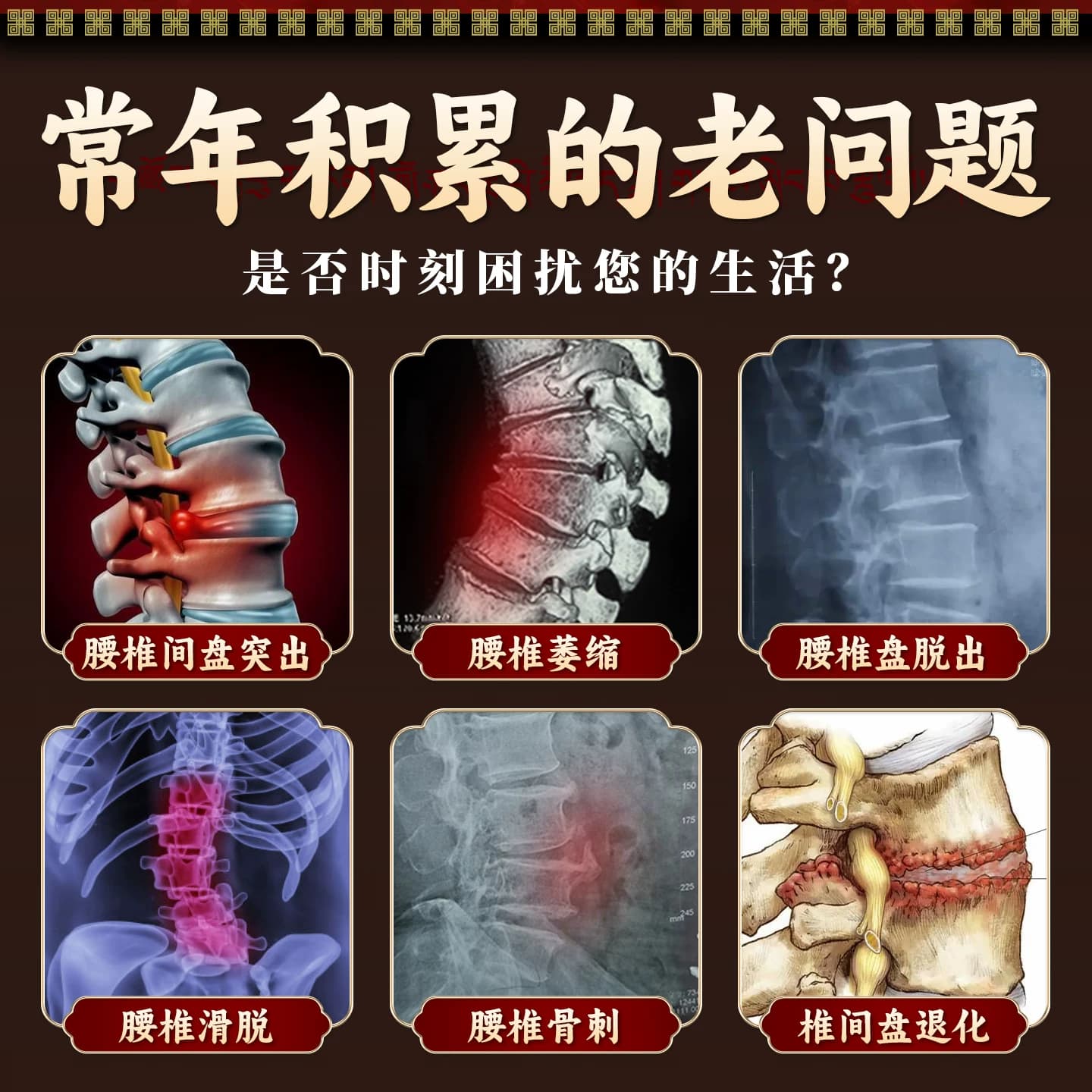 藏秘远红外治疗贴腰椎型腰椎间盘突出腰肌劳损疼痛缓解腰椎问题 - 缩略图2