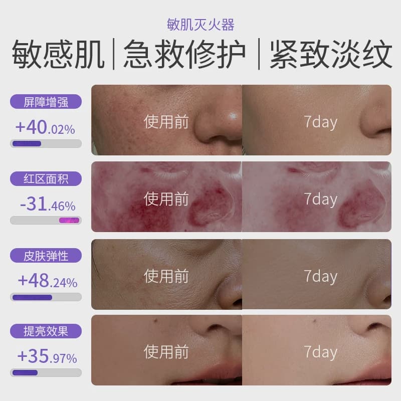 野兽贝拉【敏肌救急】野兽贝拉水光功效型快速修护面膜熬夜提亮 - 缩略图3