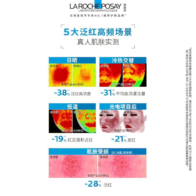 【孙颖莎推荐】理肤泉超级B5精华多效修护舒缓紧致补水保湿灭火火 - 缩略图4