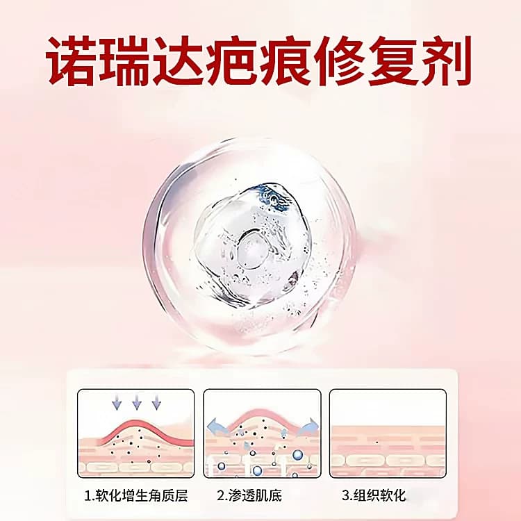 诺瑞达疤痕修复剂10g/支SZ - 缩略图3