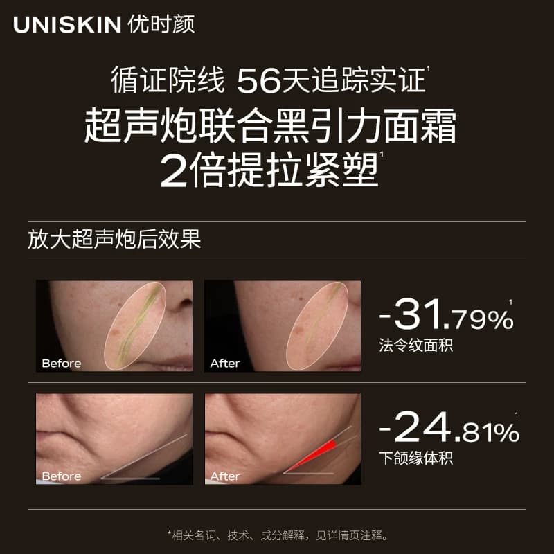 【官方正品】优时颜第二代黑引力面霜修护紧致保湿抗皱舒缓霜 - 缩略图4