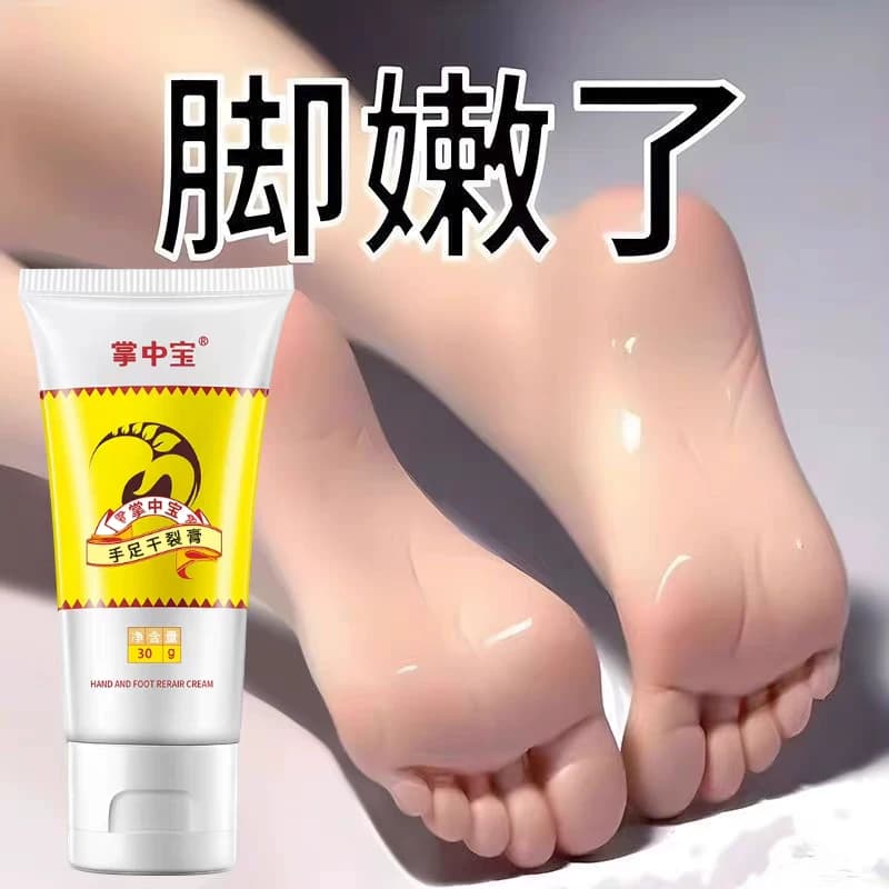 掌中宝干裂修护膏脚后跟皲裂脚裂手裂膏皴裂口龟裂防裂霜护手霜 - 缩略图4