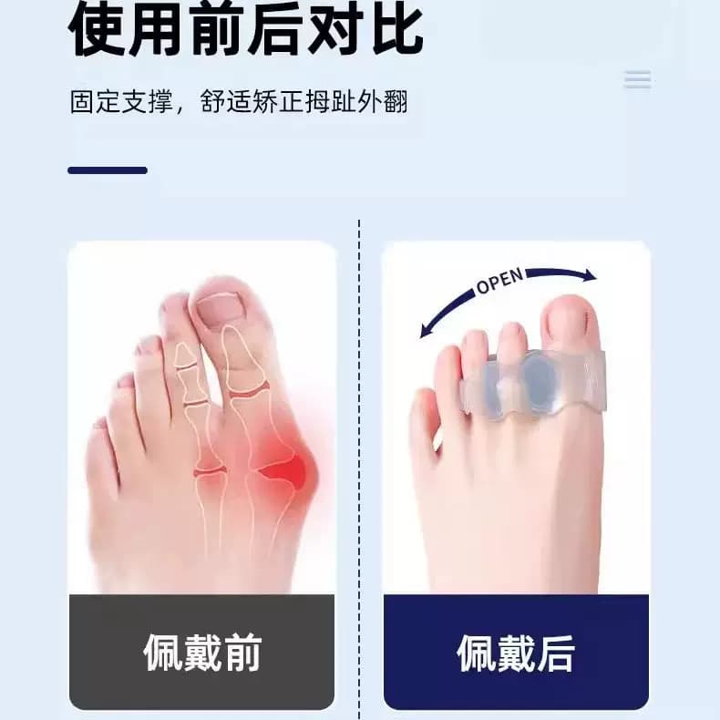 脚趾硅胶防磨分趾套脚趾分离防磨透气Q弹穿鞋足部防护套四季适用 - 缩略图5