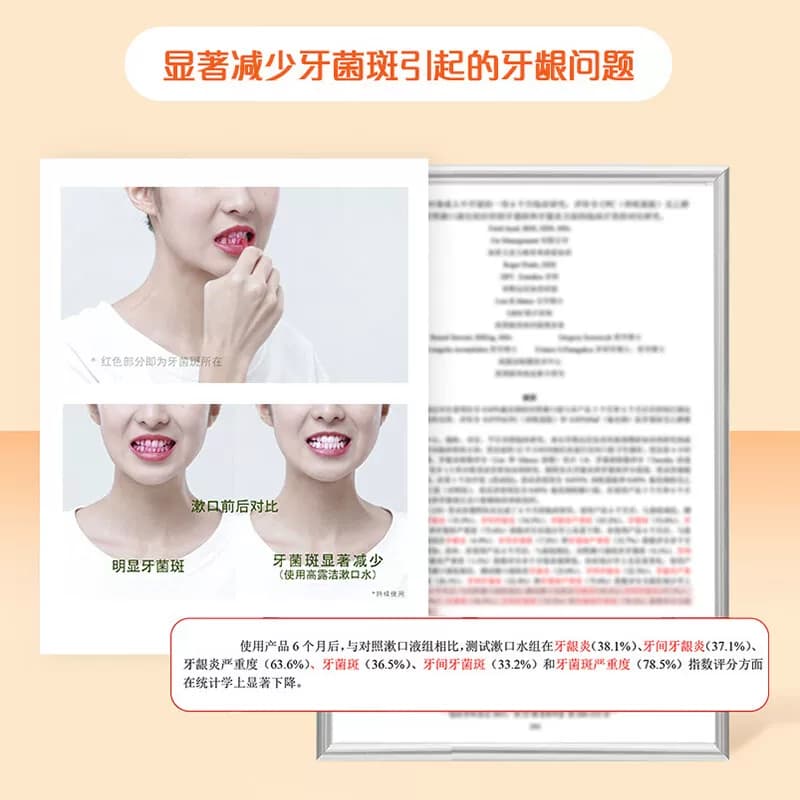 高露洁鲜爽柑橘味漱口水清新口气成人牙龈护理无酒精 - 缩略图4
