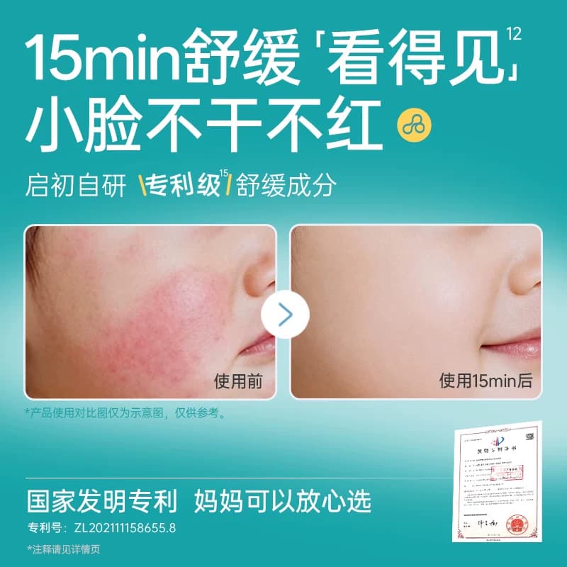 【3.0升级】启初儿童面霜胚米秋冬补水婴儿保湿霜舒缓敏感肌宝宝 - 缩略图4