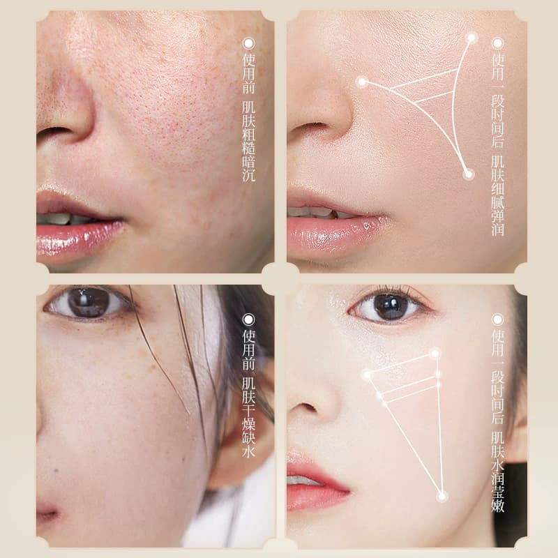 植萃黄芪霜以黄去黄淡纹补水保湿紧致熬夜提亮改善粗糙 - 缩略图3