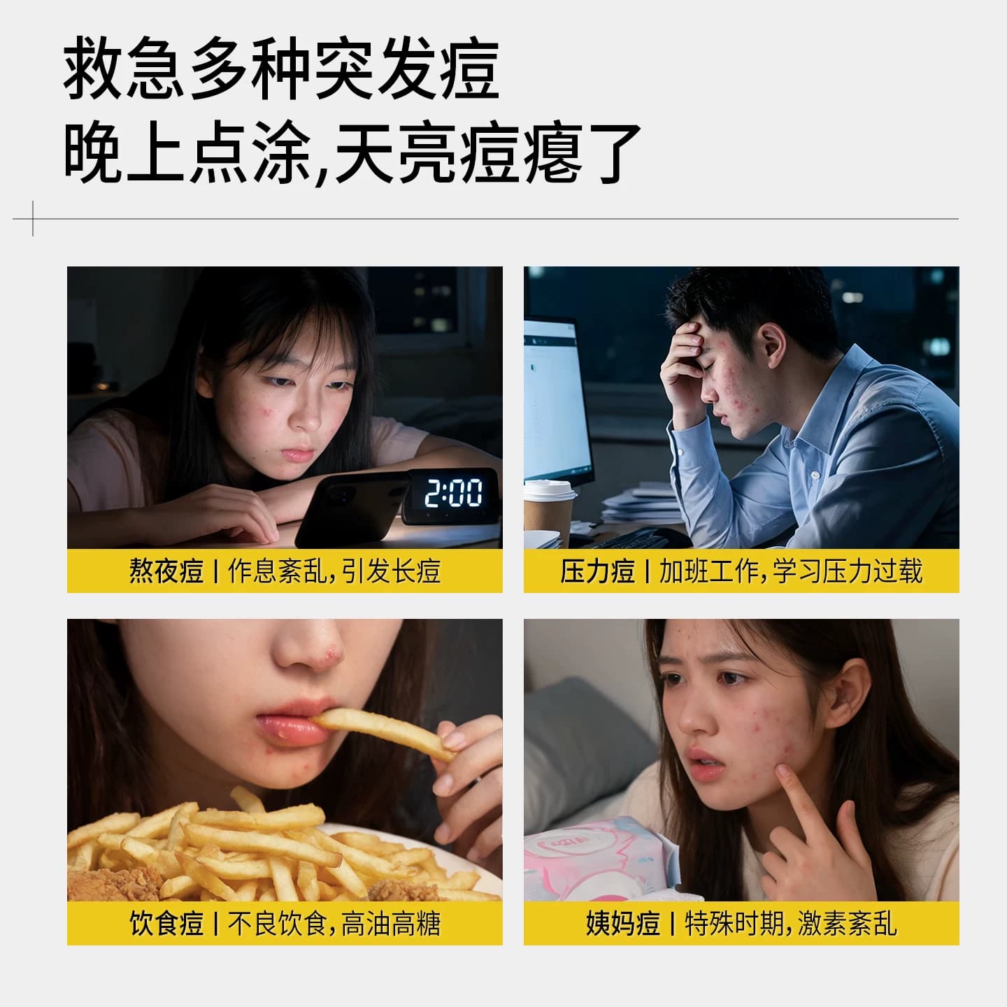 【陈梦推荐】羽素祛痘大灯泡精华液无酸胶态硫舒缓修护淡化痘印女 - 缩略图5