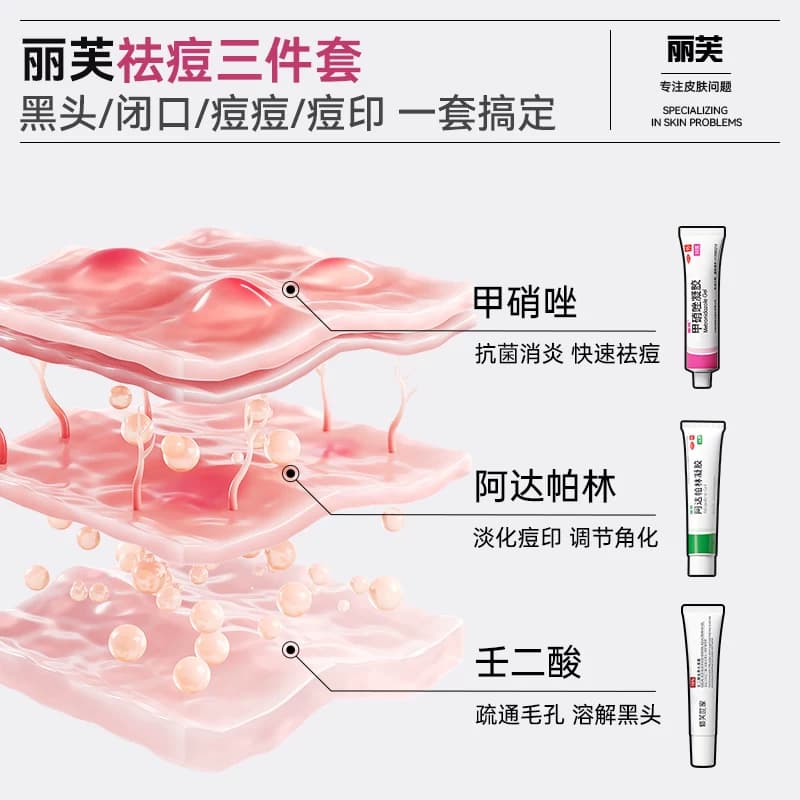 丽芙甲硝唑凝胶正品壬二酸祛痘药膏修护淡化医用消炎痘痘用药药房 - 缩略图5