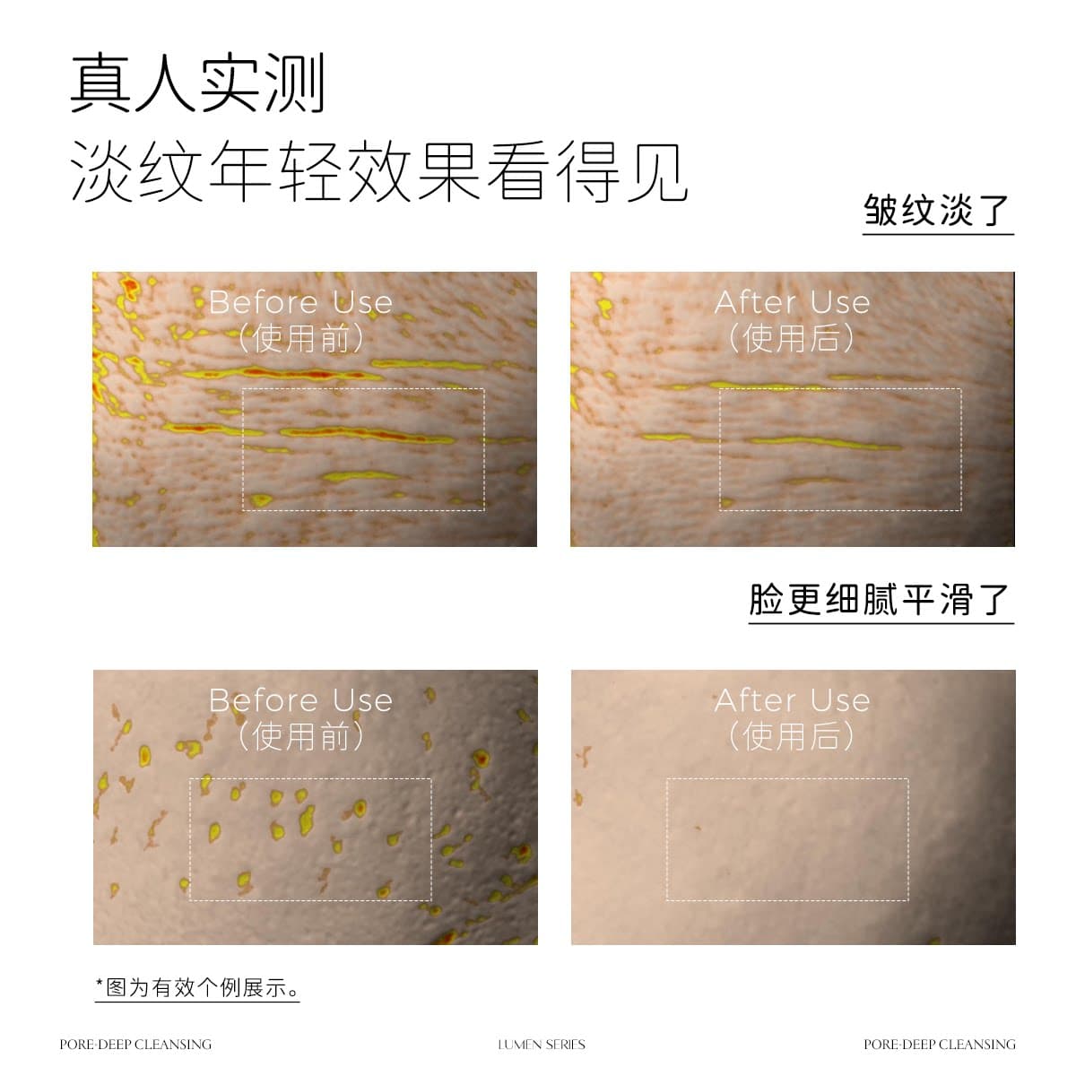 CEMOY澳诗茉白金水乳套装胶原抗皱紧致舒缓修护保湿护肤品礼盒 - 缩略图4