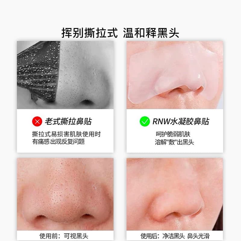 rnw去黑头鼻贴官方旗舰店导出液收缩贴毛孔清洁温和男女草莓鼻 - 缩略图2