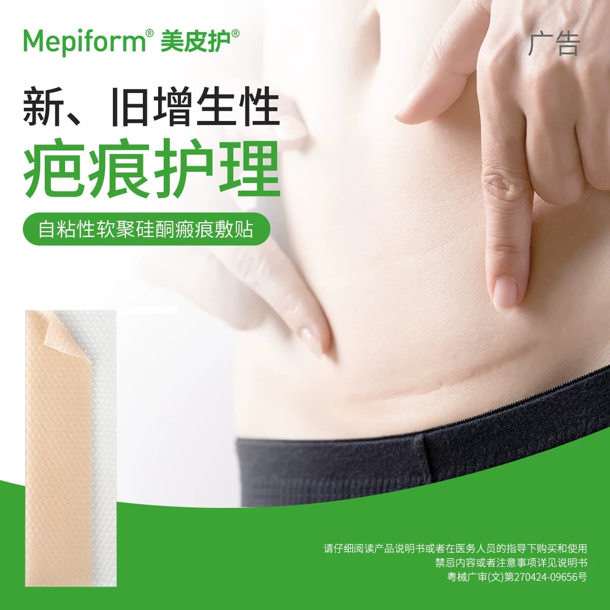 美皮护疤痕贴新旧疤痕增生去疤贴双眼皮疤护理祛疤膏医用硅酮凝胶 - 缩略图5