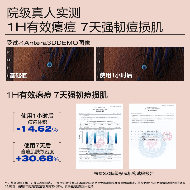 大水滴3点祛痘精华3.0 祛痘淡印舒缓痘肌青少年去痘痘贴淡化红印 - 缩略图4