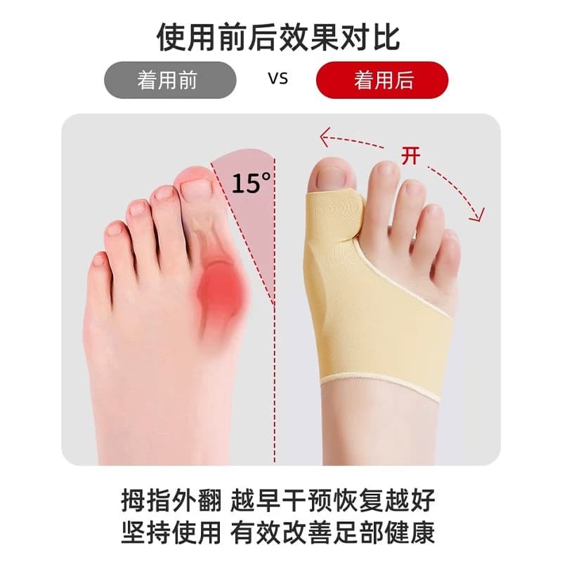 日本脚趾矫正器拇指外翻纠正分趾神器男女士大母足脚骨突出可穿鞋 - 缩略图3
