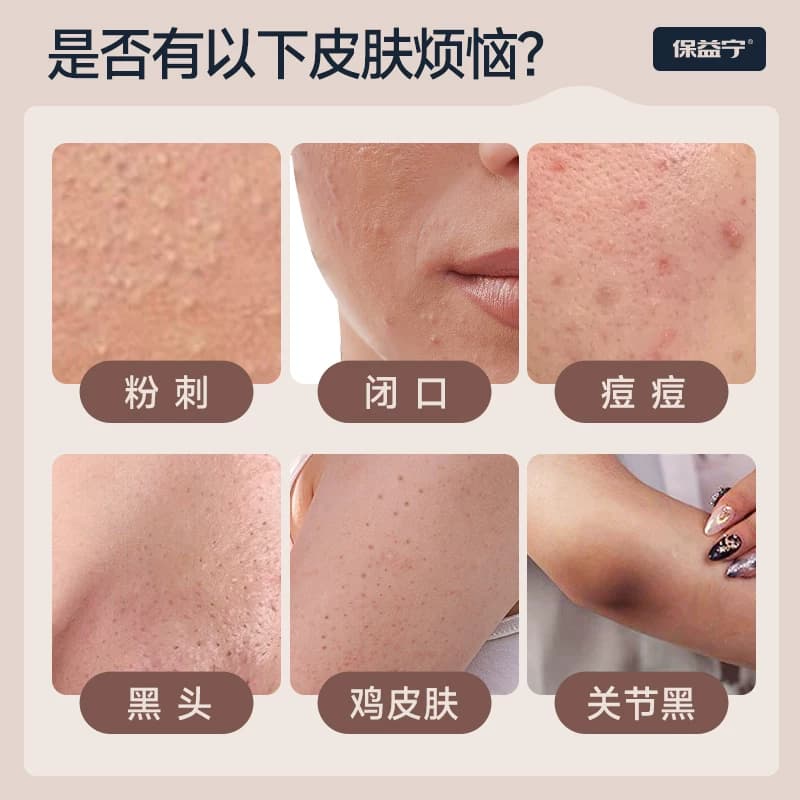 维a酸乳膏医用官方旗舰店去颈纹去老年斑维a酸乳胶膏和尿素维e乳 - 缩略图2