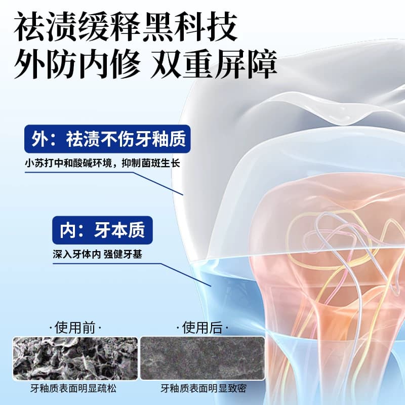 牙益生涂氟笔牙齿涂氟剂正畸儿童宝宝成人家用保护漆防蛀防龋氟化 - 缩略图5