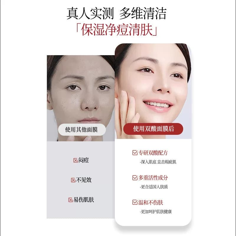 壬二酸水杨酸祛痘面膜淡化痘印痘坑收缩毛孔补水保湿男女紧致修复 - 缩略图3