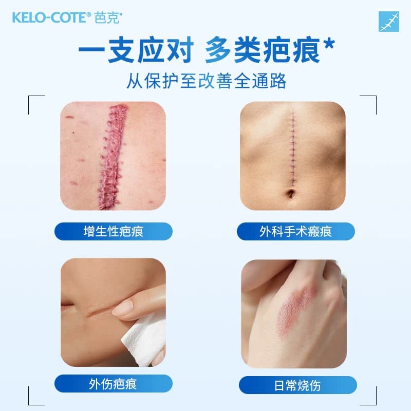 芭克硅酮疤克祛疤膏修复去除疤进口医用凝胶6g增生官方剖腹产巴克 - 缩略图3