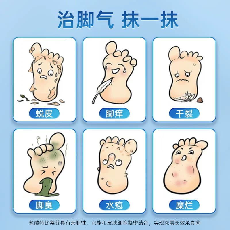 盐酸特比萘芬乳膏正品旗舰店脚气药膏止痒杀菌真菌感染治疗脚气药 - 缩略图2