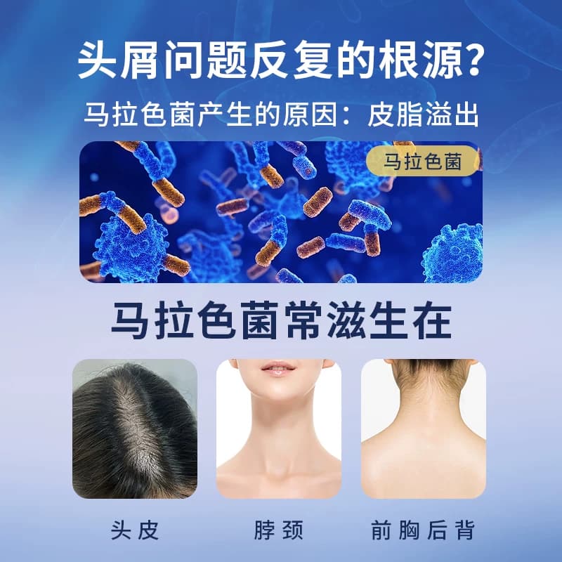 希尔生二硫化硒洗剂二硫化硒洗头水控油洗发水头皮屑专用洗发液 - 缩略图3