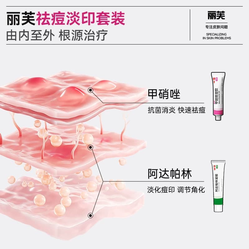 丽芙阿达帕林凝胶正品医用膏祛痘药膏黑头闭口痤疮阿达帕林去黑头 - 缩略图2