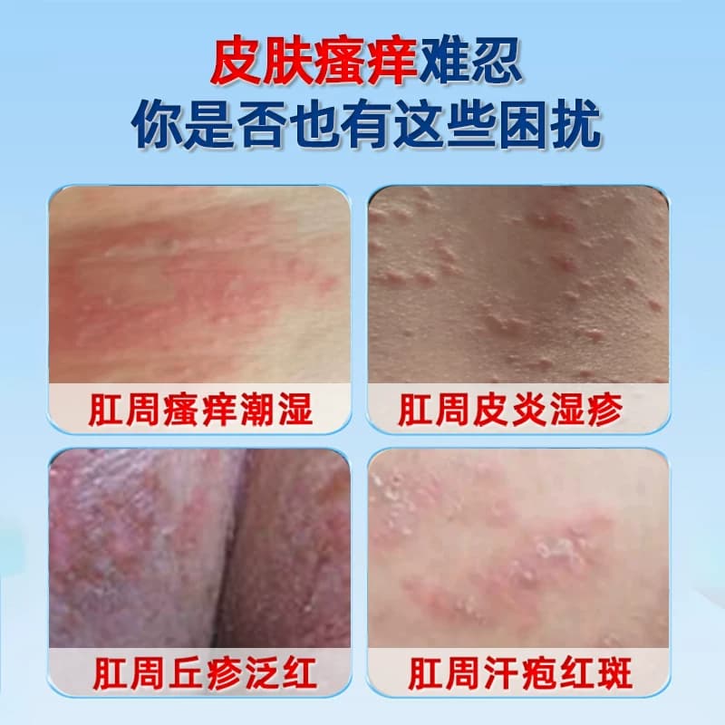 朕医生医用聚乙二醇皮肤护创敷料瘙痒潮湿泛红渗液专用zj - 缩略图2