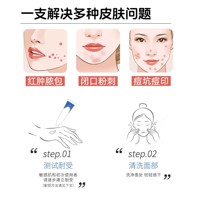 明康欣阿达帕林凝胶膏阿达帕林凝胶正品医用官方旗舰店祛痘痘药膏 - 缩略图3