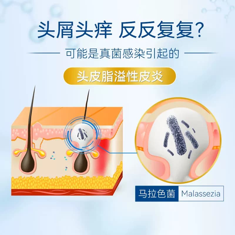 康王酮康唑洗剂去屑止痒二硫化硒洗发水液脂溢性皮炎头皮屑非复方 - 缩略图3