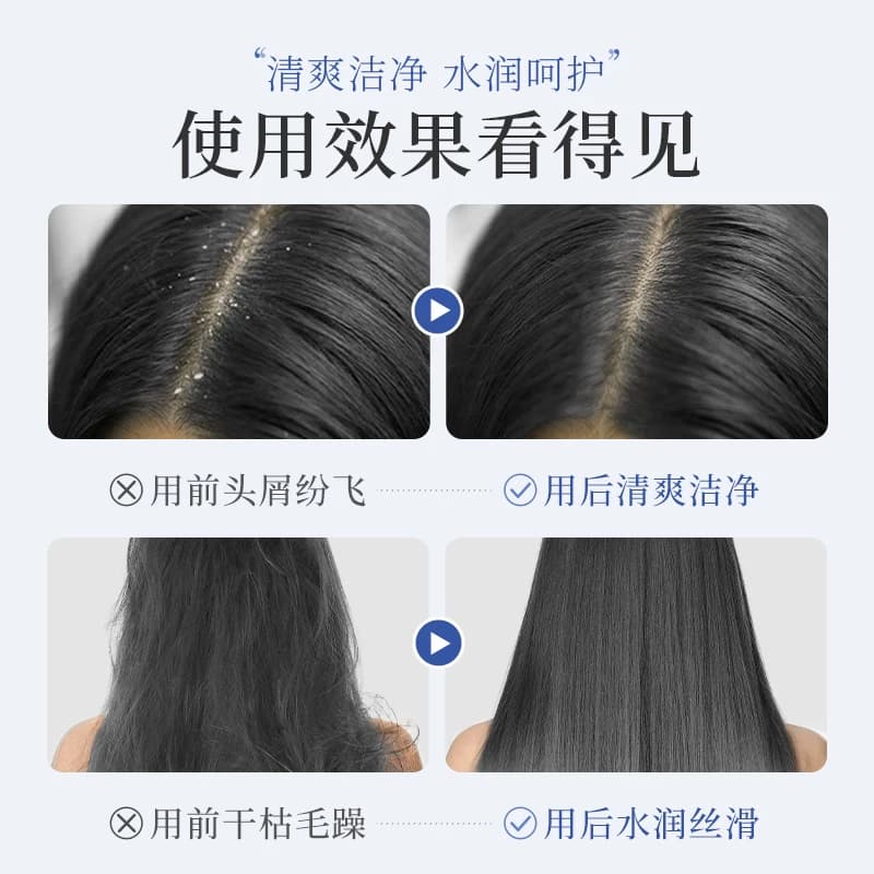 二硫化硒去屑洗发水液头皮毛囊清洁止痒洗头控油蓬松膏炎持久留香 - 缩略图4