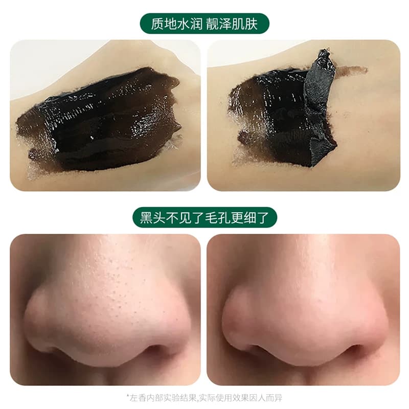 拍1发3！到手3瓶！左香水杨酸去黑头面膜膏补水滋润女护肤鼻膜贴 - 缩略图2