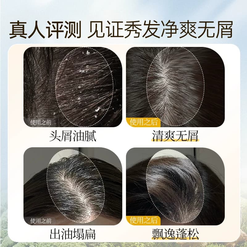 霸王姜汁首乌洗发水生姜控油蓬松洗发露头皮去屑止痒固发洗头膏女 - 缩略图4