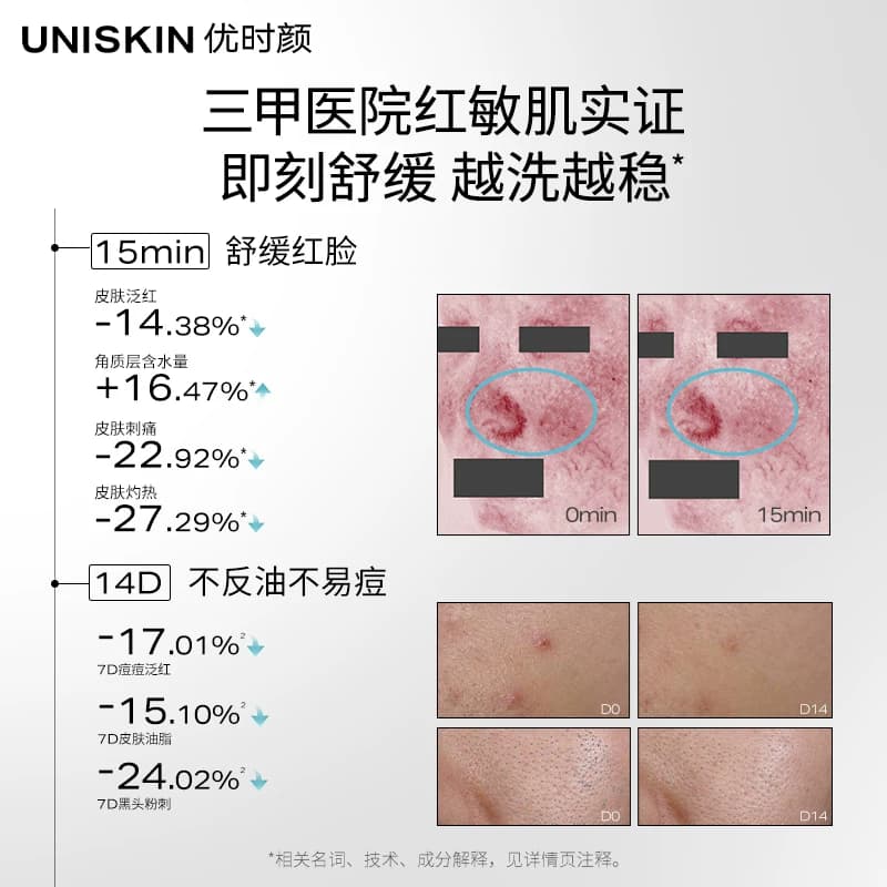 优时颜B5至简洁面氨基酸糖脂温和敏感干皮油皮卸防晒控油洗面奶 - 缩略图3