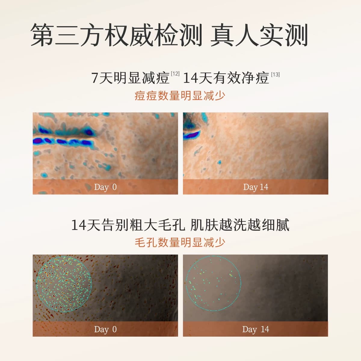 半亩花田氨基酸洁面慕斯控油皮祛痘深层清洁男女青少年正品洗面奶 - 缩略图3