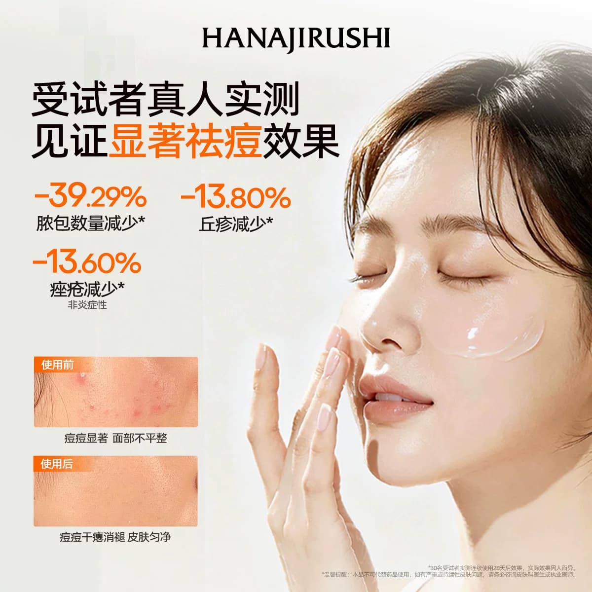 花印进口祛痘凝露精华凝胶淡化痘印青春痘痘坑痘疤胶旗舰店进口 - 缩略图3